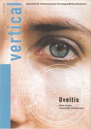 Uveitis - Schweizerische Vereinigung Morbus Bechterew