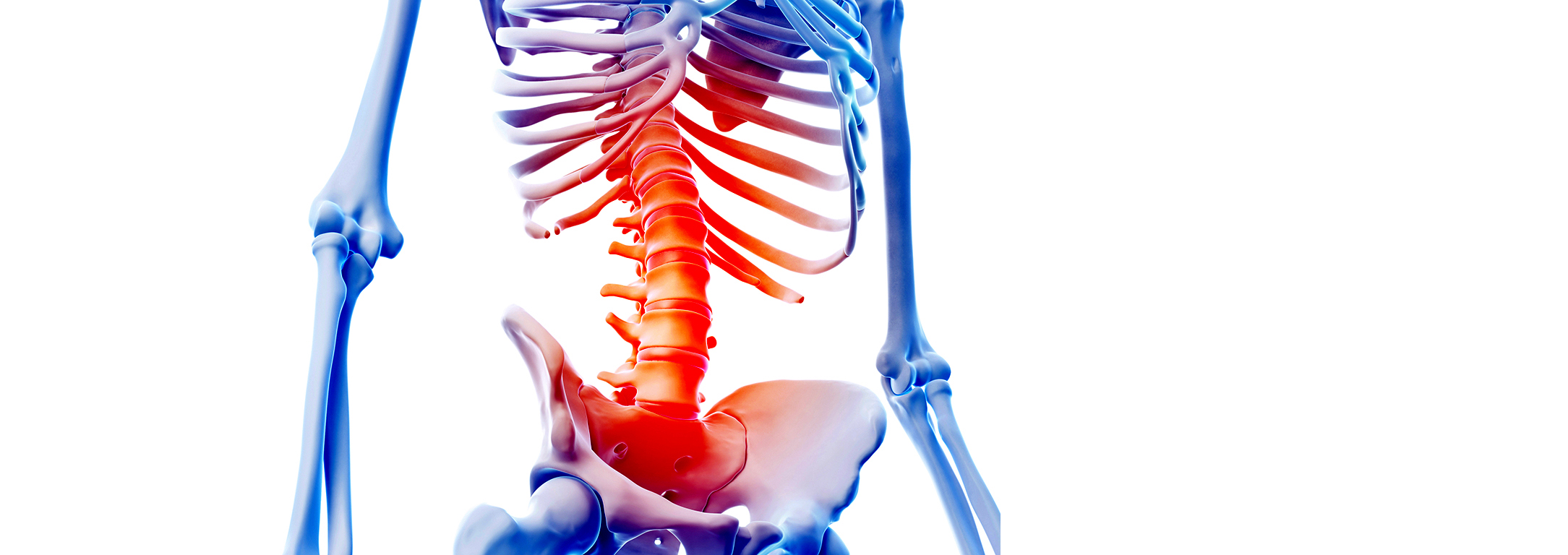 Spondyloarthrite axiale (spondylarthrite ankylosante): un état des lieuxImage héro