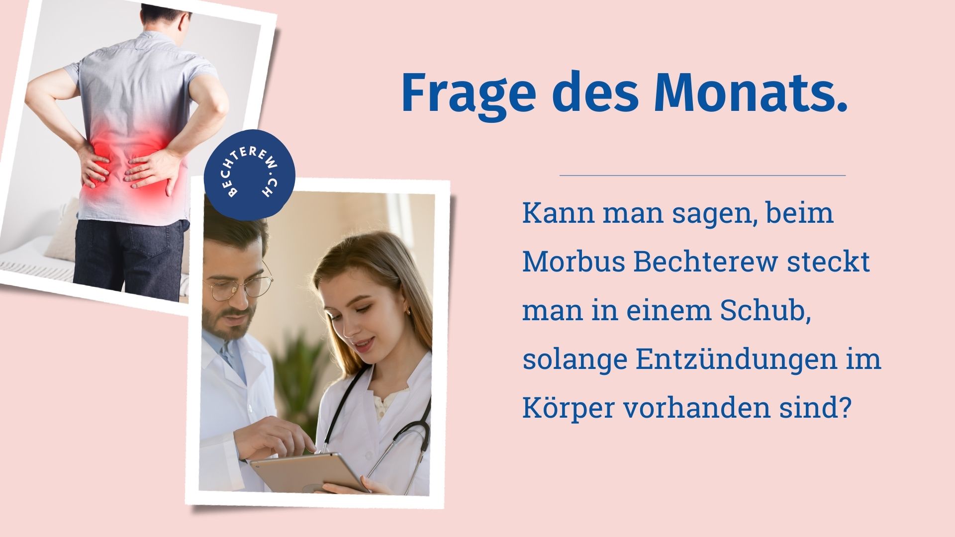 Kann man sagen, beim Morbus Bechterew steckt man in einem Schub