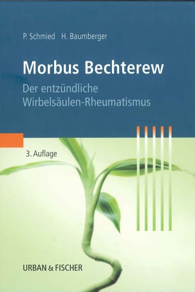 morbus-bechterew-entzündliche-wirbelsäule_size2